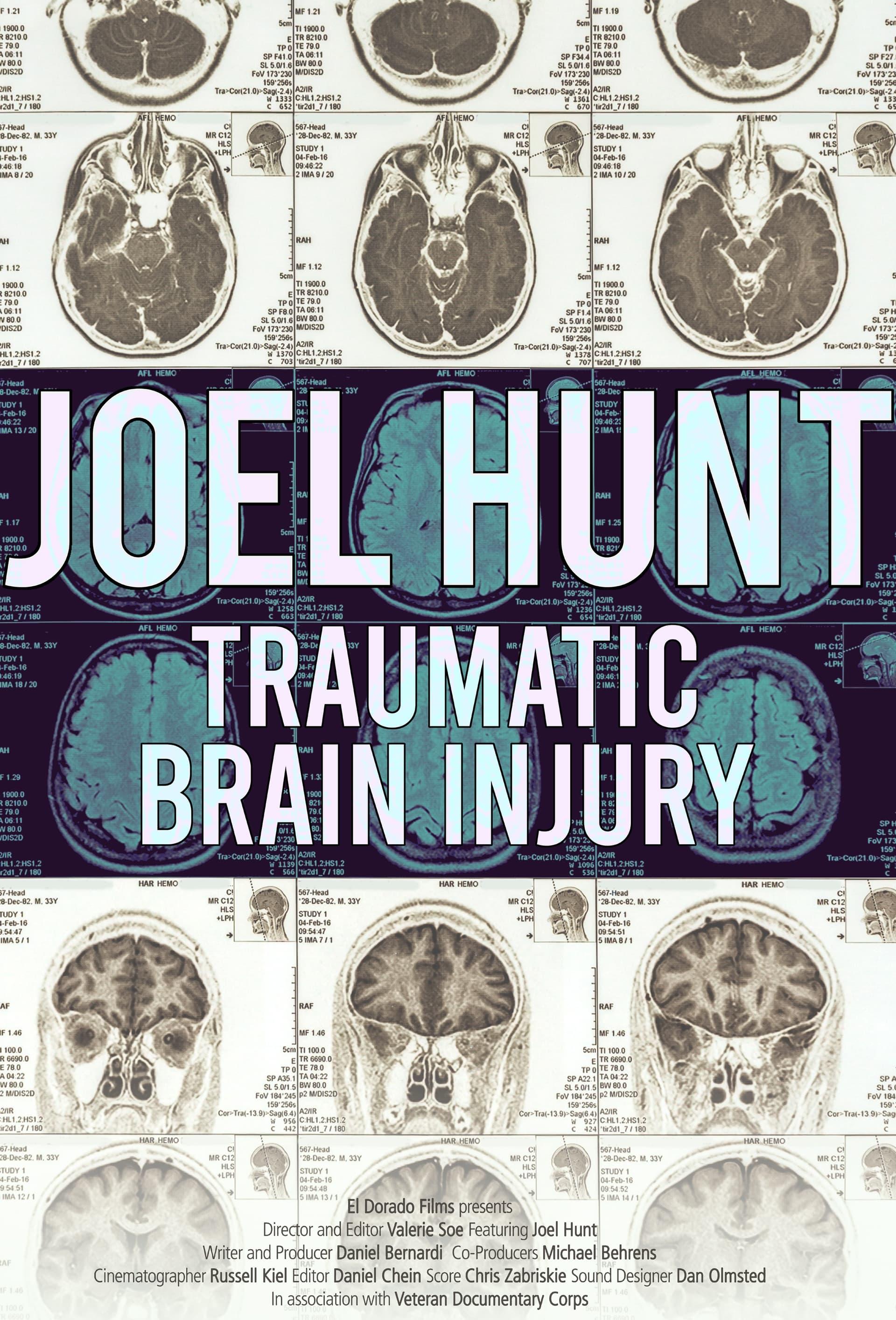Joel Hunt: Traumatic Brain Injury (TBI) poster